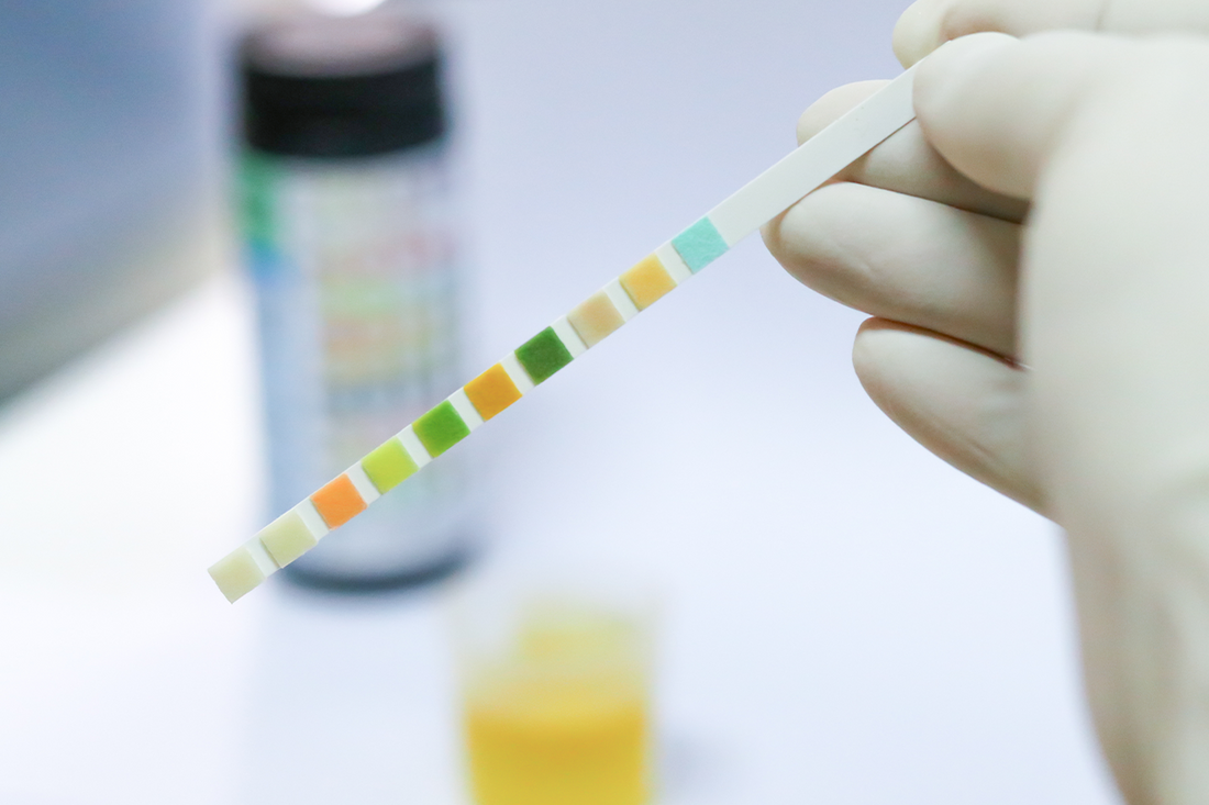 What Does Urine Glucose Levels Chart Indicate?